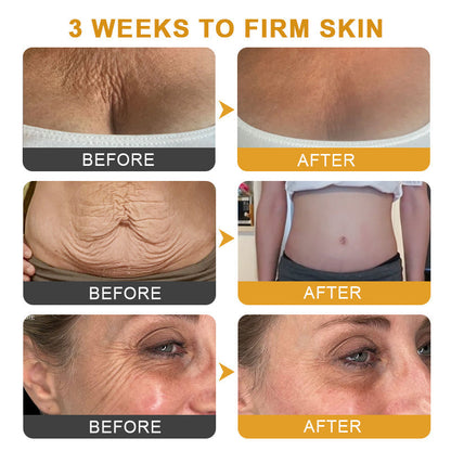 ApisDerm™ Botox BeeVenom WrinkleFirming Multi-Purpose Cream 2