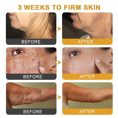 ApisDerm™ Botox BeeVenom WrinkleFirming Multi-Purpose Cream 2