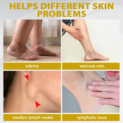 ATTDX® ApisChestnut Herbal Edema Relief Cream