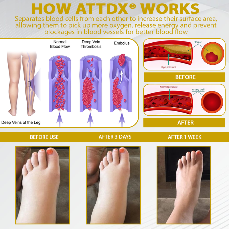 ATTDX® ApisChestnut Herbal Edema Relief Cream