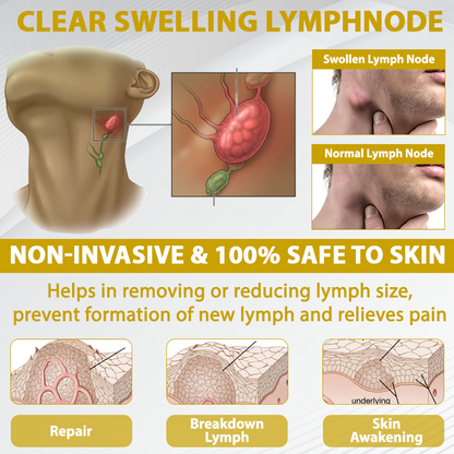 ATTDX® ApisChestnut Herbal Edema Relief Cream