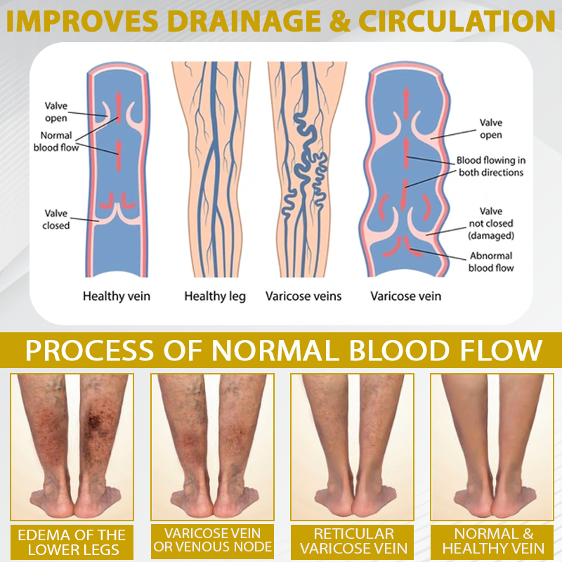 ATTDX® ApisChestnut Herbal Edema Relief Cream