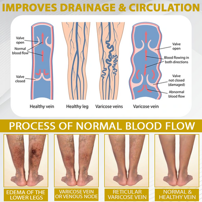 ATTDX® ApisChestnut Herbal Edema Relief Cream