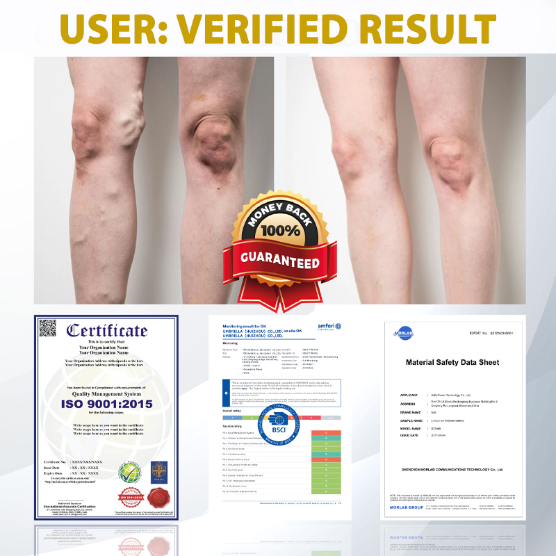 ATTDX® ApisChestnut Herbal Edema Relief Cream