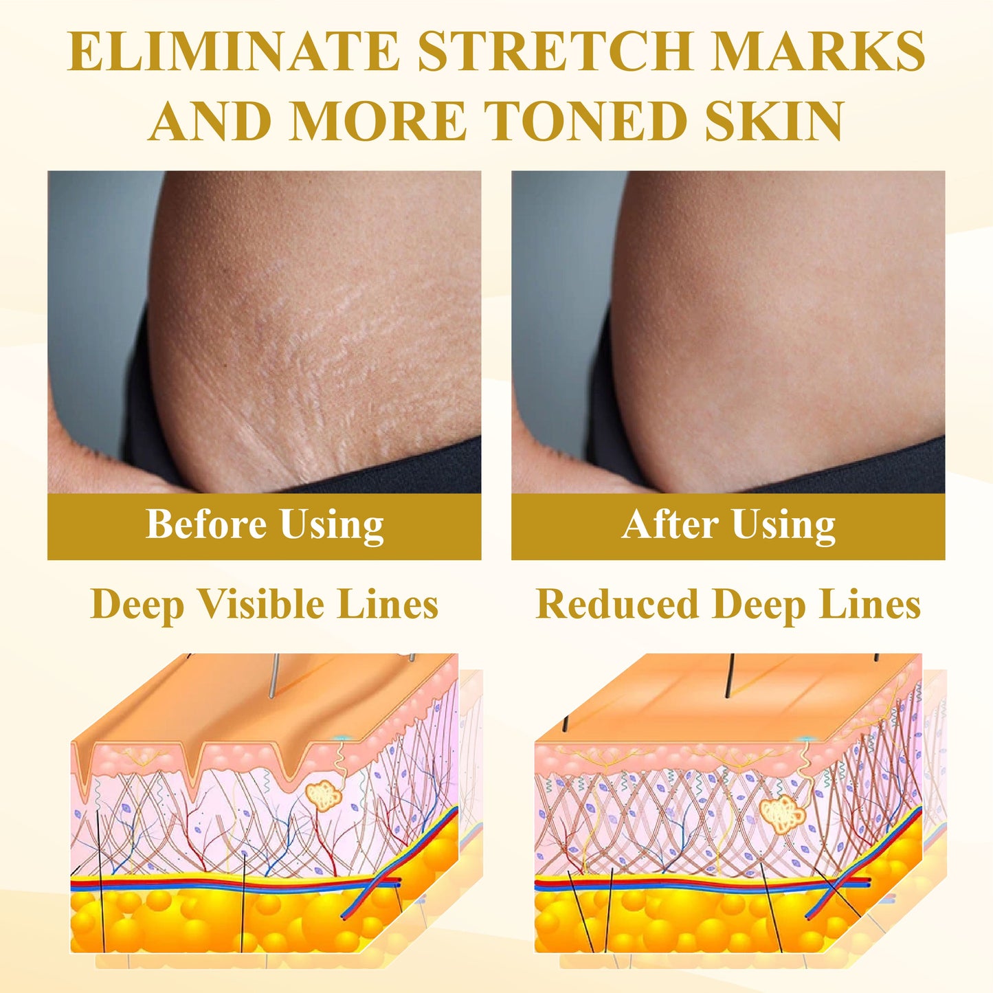 ATTDX® ApisPDRN DermoFirm Lifting Cream