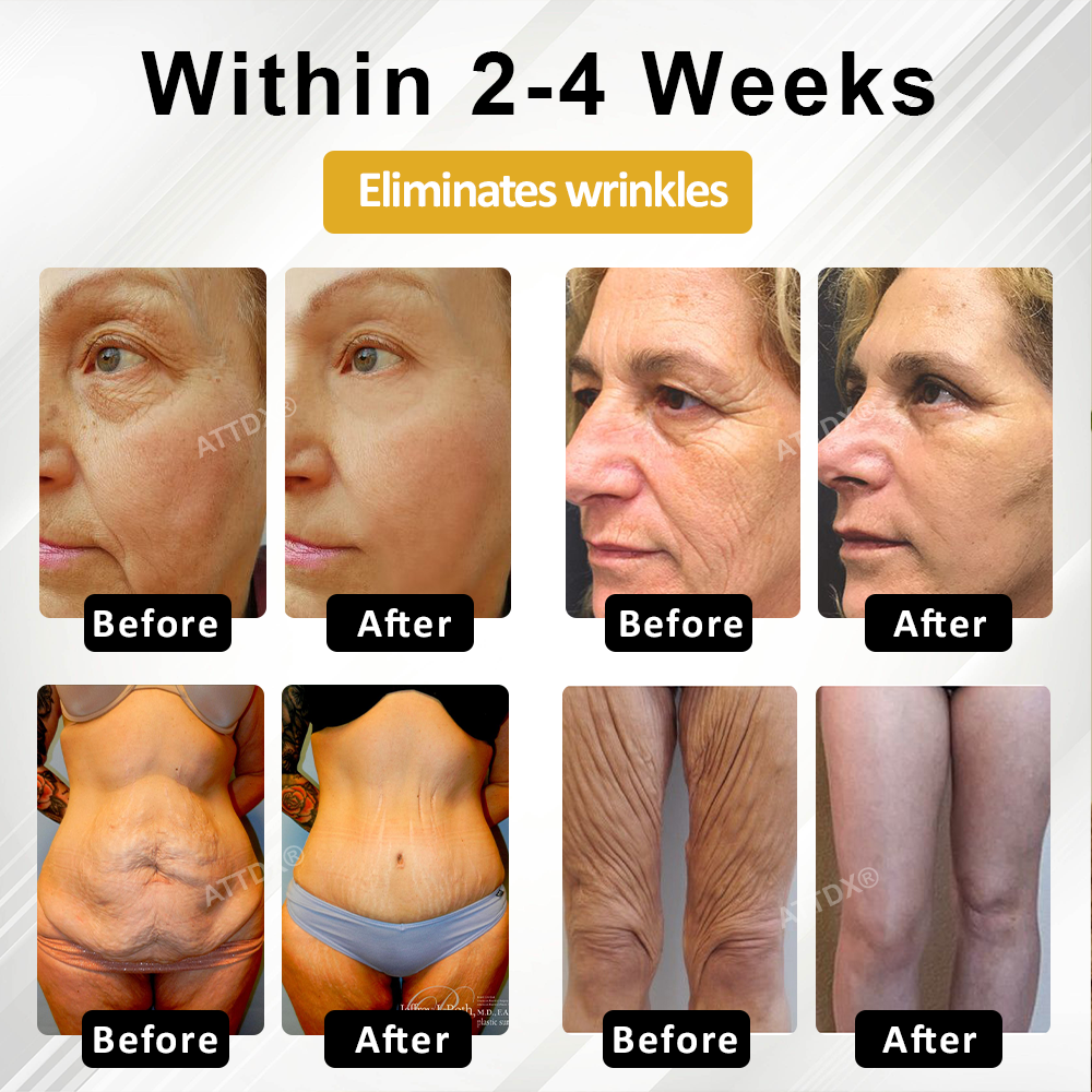 ATTDX® ApisPDRN DermoFirm Lifting Cream