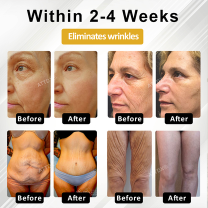 ATTDX® ApisPDRN DermoFirm Lifting Cream