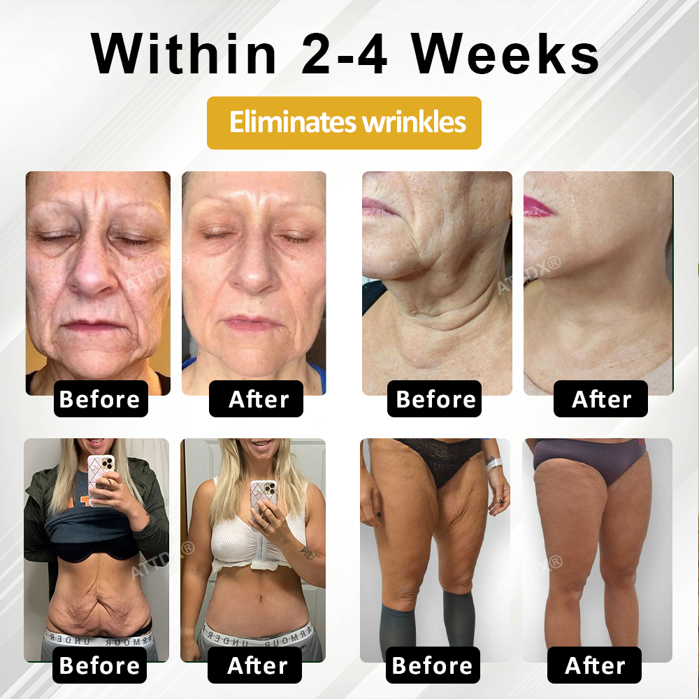 ATTDX® ApisPDRN DermoFirm Lifting Cream