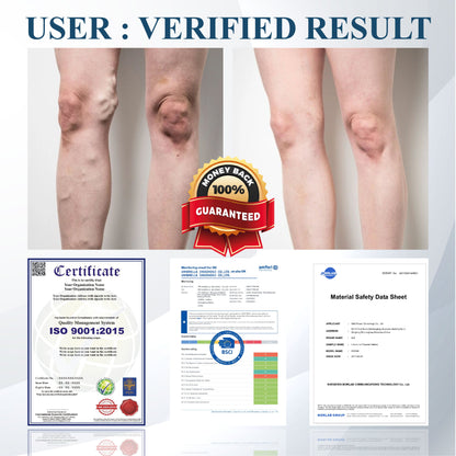 ATTDX® Black Cumin Edema Soothing Herbal Cream