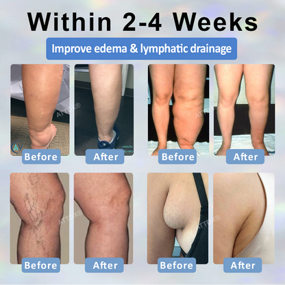 ATTDX® Black Cumin Edema Soothing Herbal Cream 2