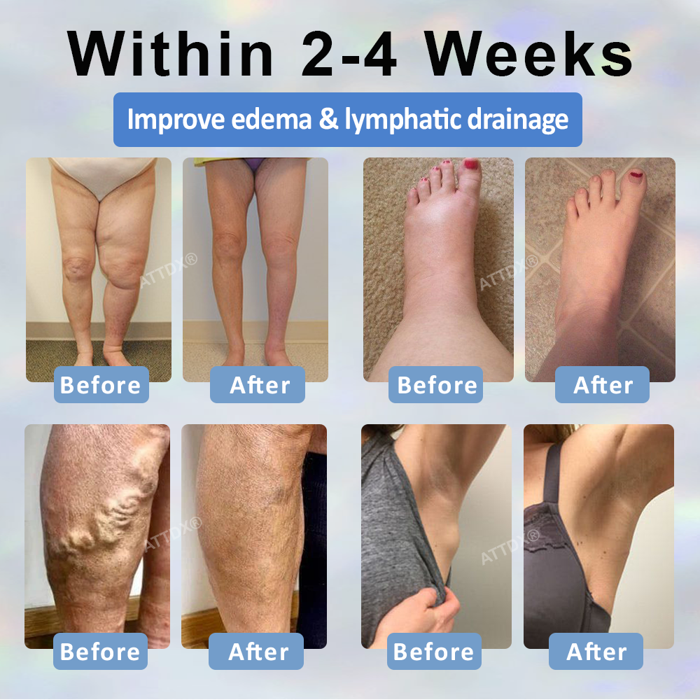 ATTDX® Black Cumin Edema Soothing Herbal Cream