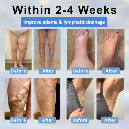 ATTDX® Black Cumin Edema Soothing Herbal Cream 2