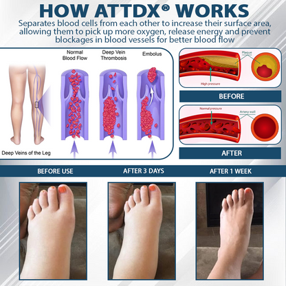 ATTDX® EdemaEase Black Cumin Therapy Cream