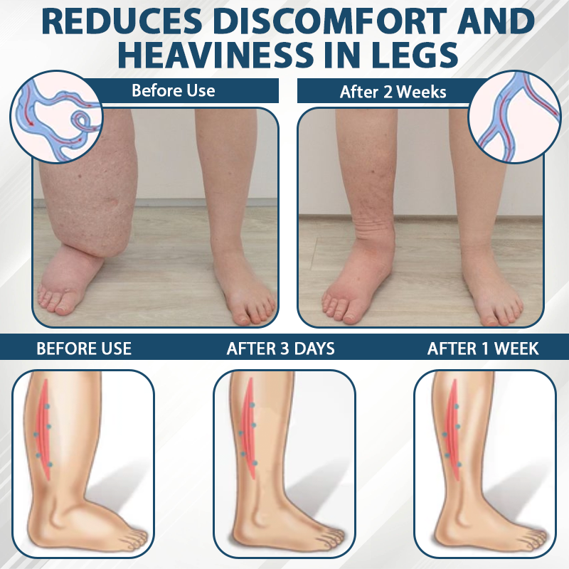 ATTDX® Black Cumin Edema Soothing Herbal Cream