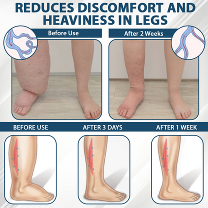 ATTDX® Black Cumin Edema Soothing Herbal Cream