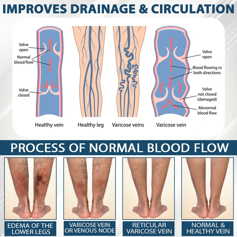 ATTDX® Black Cumin Edema Soothing Herbal Cream 2