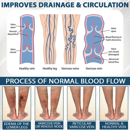 ATTDX® Black Cumin Edema Soothing Herbal Cream 2