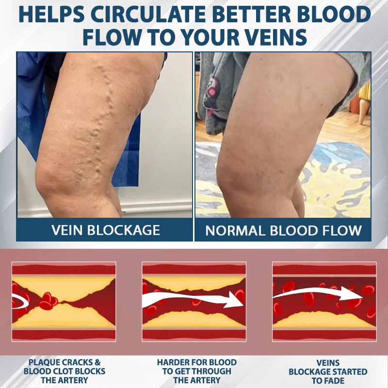 ATTDX® Black Cumin Edema Soothing Herbal Cream