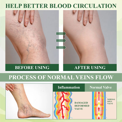 ATTDX® FluidEase Leg Therapy Edema Cream
