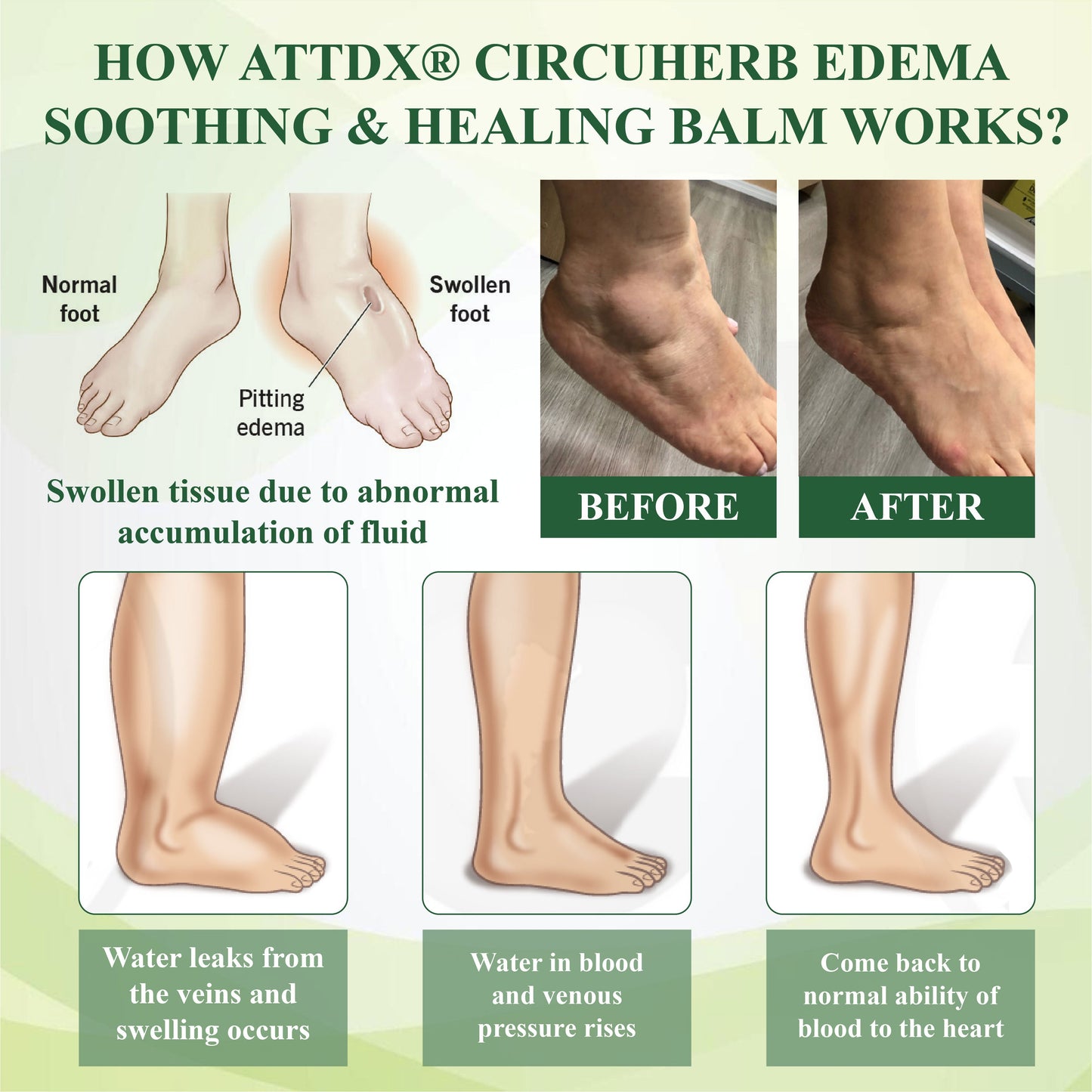 ATTDX® CircuHerb Edema Soothing & Healing Balm