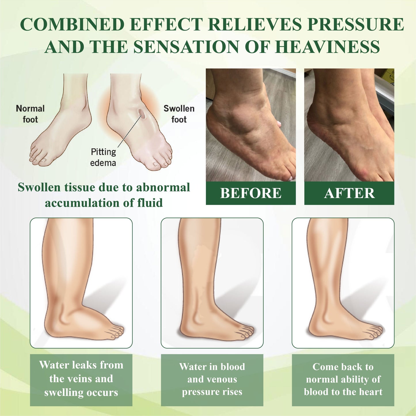 ATTDX® FlowBoost Edema Drain Herbal Roll On