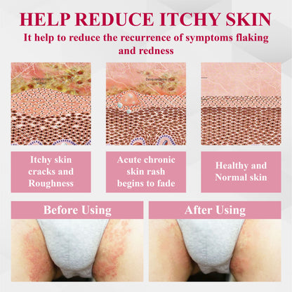 ATTDX® EndoBalance Woman's Genital HPV Healing Cream