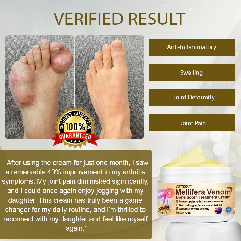 ATTDX™ Mellifera Venom BoneSooth Treatment Cream