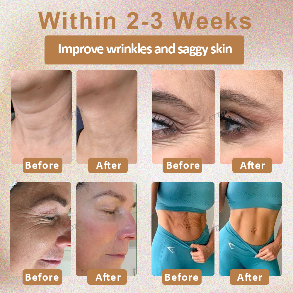 ATTDX Nano Skin Firming Body Cream Roller