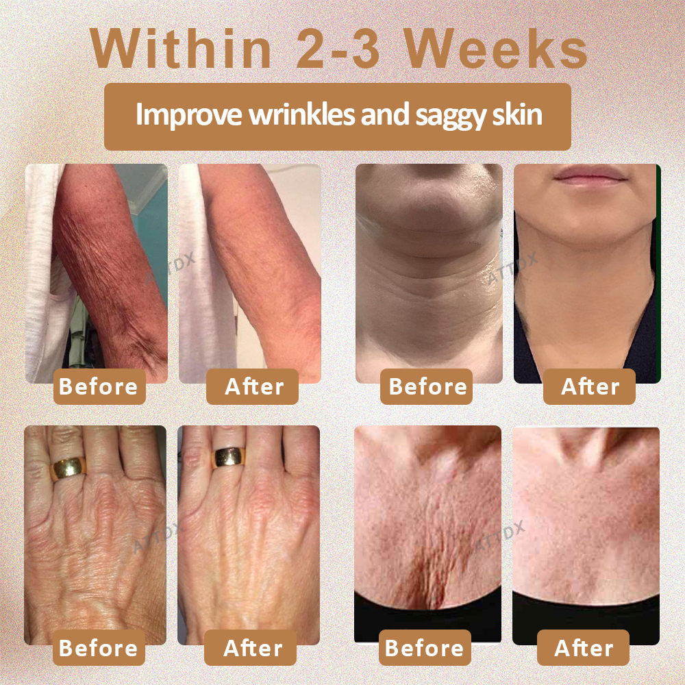 ATTDX Nano Skin Firming Body Cream Roller