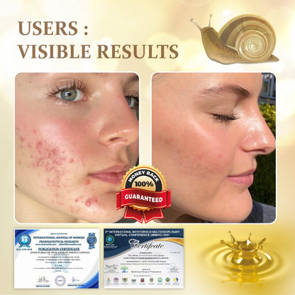 PureGlow Snail Filtrate Essence Capsules Y
