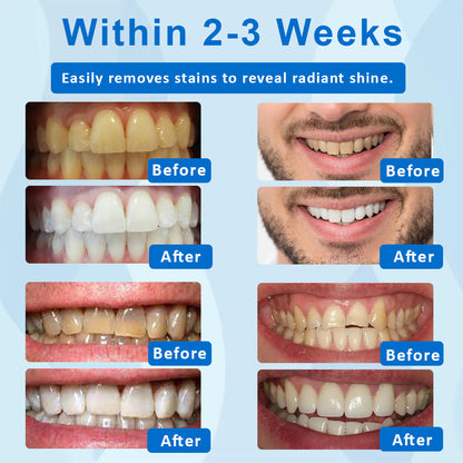 ATTDX™ NanoWhite Tooth Stain Cleaner