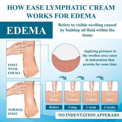 ATTDX™ SwellingEase Lymphatic Drainage Massage Cream
