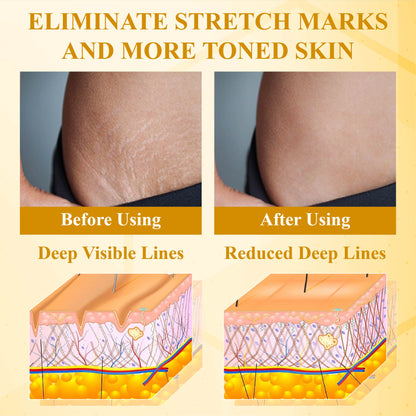 ApisDerm™ Bo-toxBee Advanced Multi-Action FirmingCream