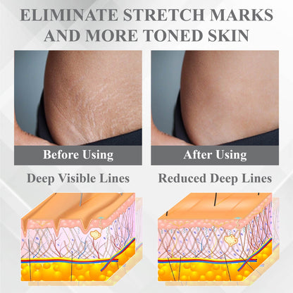 ApisDerm™ VenomDetox Moisturizing FirmingCream