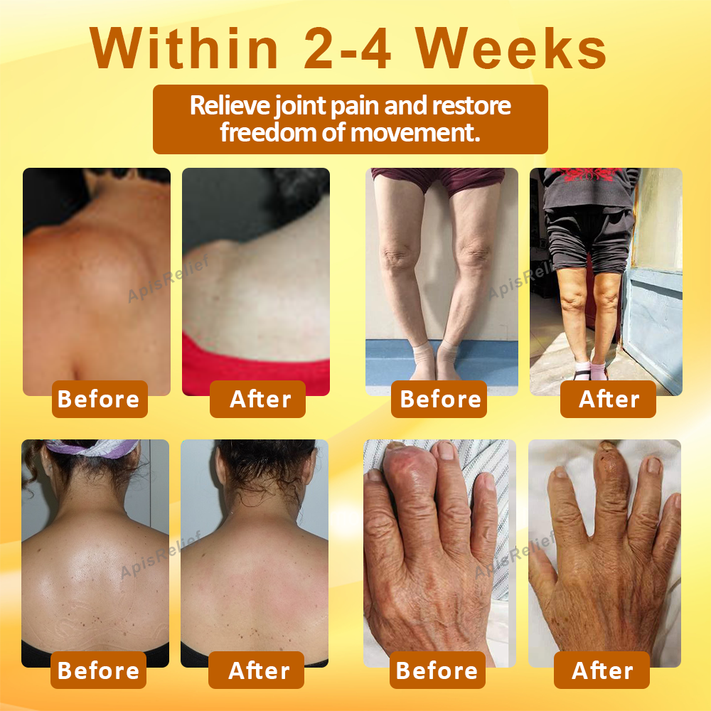 ApisRelief™ VenomFlex Joint Treatment Balm