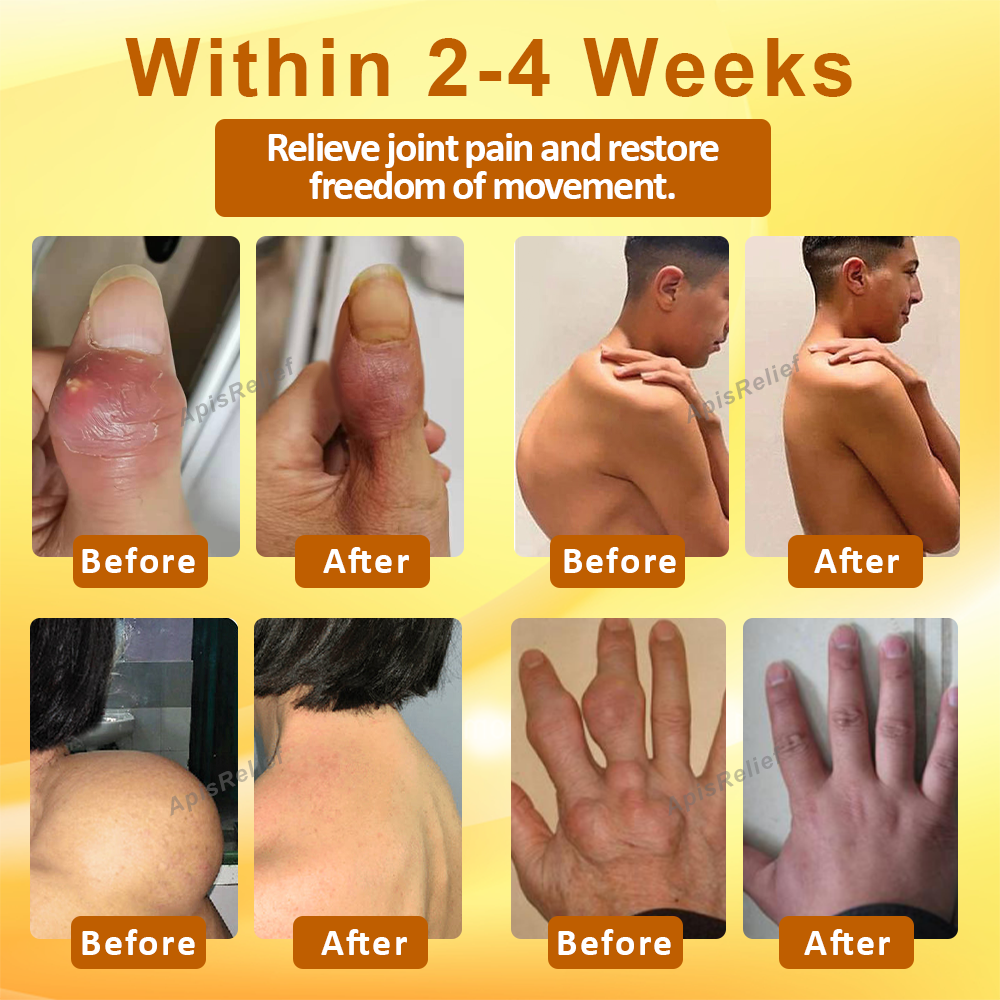 ApisRelief™ VenomFlex Joint Treatment Balm