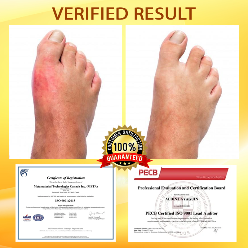 ApisRelief™ VenomFlex Joint Treatment Balm