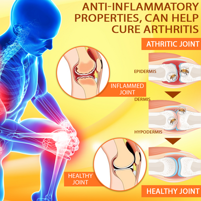 ApisRelief™ VenomFlex Joint Treatment Balm