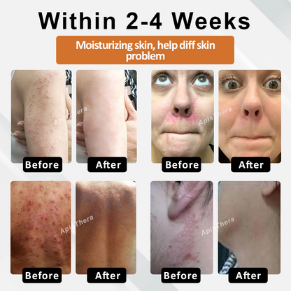 ApisThera™ MetaboDetox BeeMoisture Bath Beads