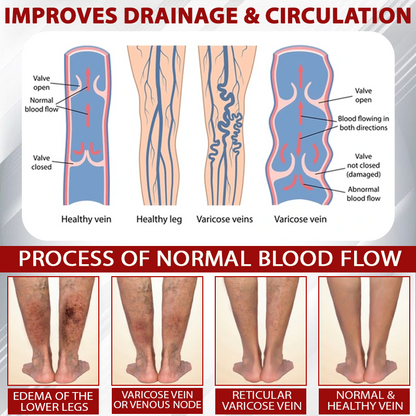 ATTDX® Red Vine FluidRelief Edema Gel