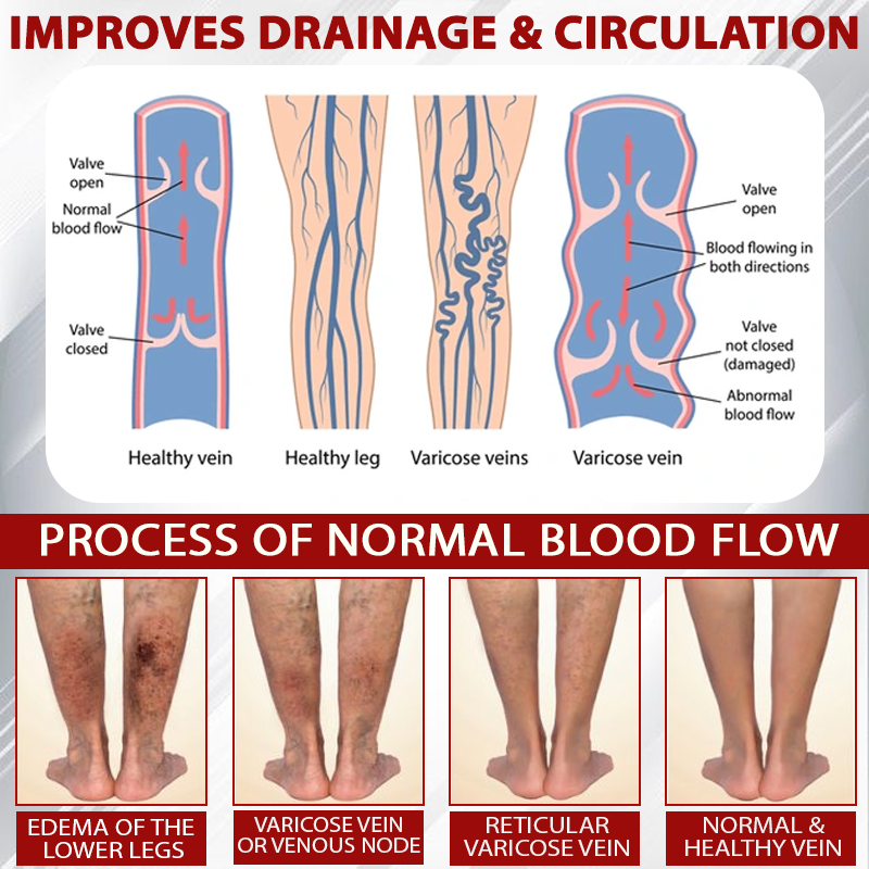 ATTDX® Advanced CVI Edema Therapy Cream