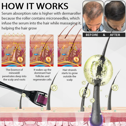 FolliFusion™ Max Absorb  MinoxidilSerum Dermaroller Kit