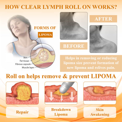 LumpFix™ Apis Venom LymphSupport Roll On