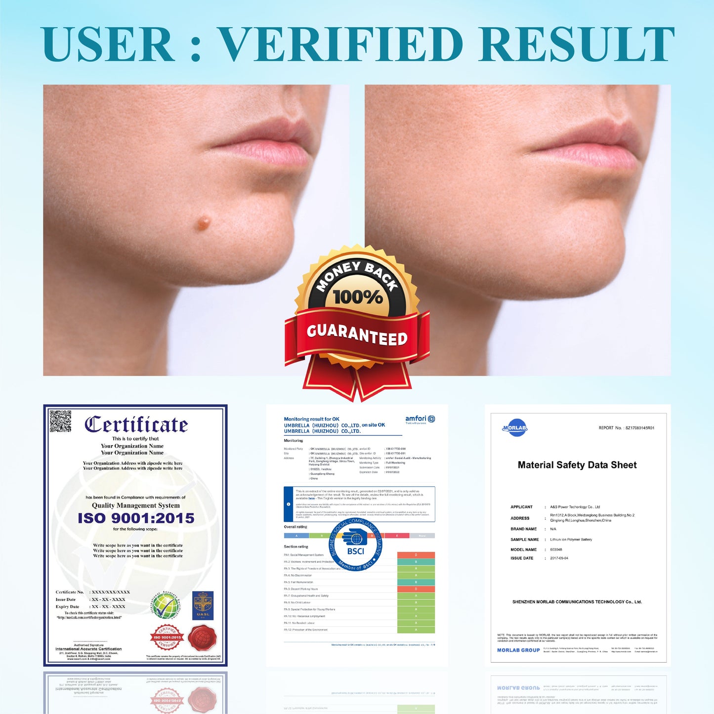 RICPIND® DermaLite Mole and Wart Removal Laser Pen